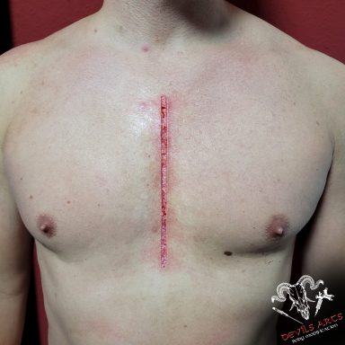 Gerade Solidaritätsnarbe als Cutting / Scarification mittig auf der Brust von DEVILS-ARTS Emmelshausen