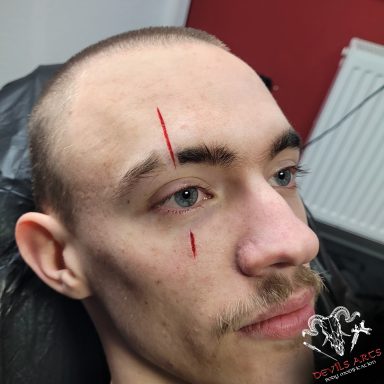Cutting Scarification im Gesicht mit zwei schmalen Schmiss-Linien an Stirn und Wange.